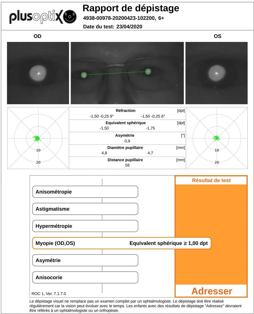 Autoréfractomètres Plusoptix - une réfraction objective en une demi-seconde, dès l’âge de 3 mois - rapport de dépistage