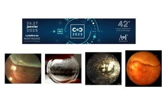 C.O.C. 2025 - un concours de photos pour les opticiens, optométristes et étudiants en optique