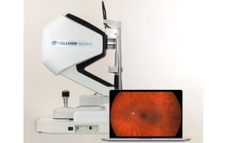 EssilorLuxottica renforce son portefeuille de solutions médicales